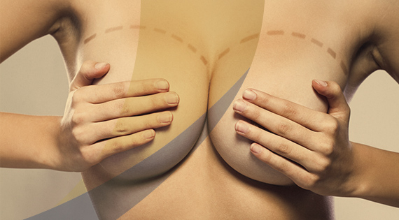 //alumnidayhospital.com.br/wp-content/uploads/2015/04/plastica-over.jpg